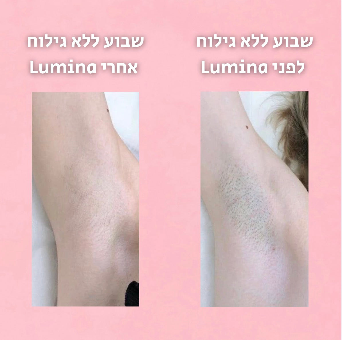 Lumina SlowGrow™ - סרום לעיכוב צמיחת שיער גוף