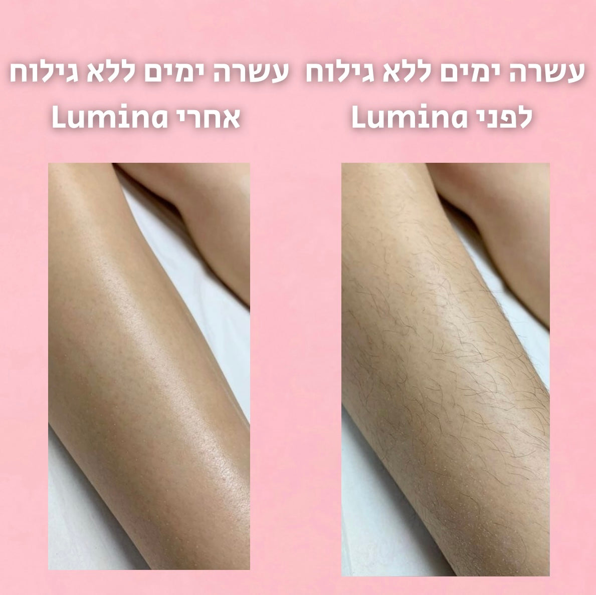 סרום לעיכוב צמיחת השיער